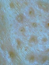 アイムエステ 表参道店(i'm este)/すっきり毛穴改善