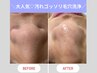 黒ずみケアNo.1◎毛穴洗浄！鼻のみ30分¥2,500