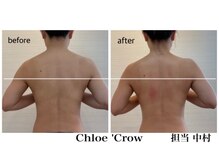 クロエクロウ(chloe'crow)/巻き肩改善
