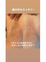 ララルアナ(Lara luana)/黒ずみ＆ザラつきOFF！脇ケア◎