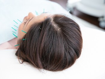 サロンラメール(Salon Lamer)/人気の頭皮鍼★頭のむくみ凝りに