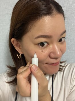 ラズ(Luz)/シミケア