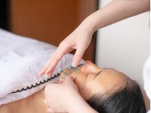 プラチナサロン 六本木の雰囲気（美容鍼でキュ－と持ち上げる♪初回¥4,980リフトアップ！小顔に！）