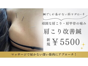 鍼灸院 はりエイト/■肩こりケア鍼