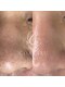 コアラル 恵比寿(COALALU)の写真/モテるメンズの身だしなみ革命】毛穴・眉・ひげを整えて清潔感アップ。第一印象を格上げ！垢抜け好印象