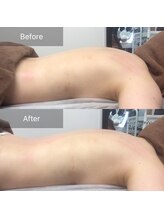 レリール バイ エレクトロ(Rerire by electro)/美骨調整