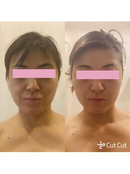 リラブルー(Lilas Bleu)/小顔メソッド