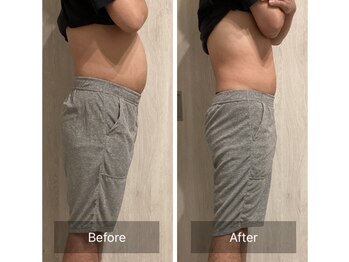 ケービューティー 小顔(K-beauty)/