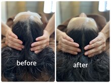 デューン 蕨店(Dune)/ドライヘッドスパ