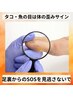 身体の歪みサイン、タコ・魚の目。放置はNG！