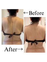 エミア(Emia)/ガチガチ肩凝りにオススメ◎