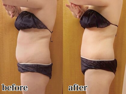 リーインカーナ アーティスト(REINCARNA ARTIST)の写真