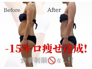 リヴェーヌ 呉羽店(Riverne)の写真/筋膜リリースでガツンと!痩身マシンでセル脂肪分解・脂肪術を組み合わせでナイスボディへ◎