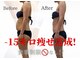 リヴェーヌ 呉羽店(Riverne)の写真/筋膜リリースでガツンと!痩身マシンでセル脂肪分解・脂肪術を組み合わせでナイスボディへ◎