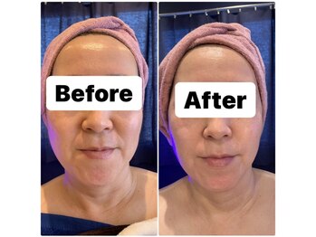 ルーシー(Lucy)/フォースカッターフェイシャル!