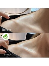 カイロプラクティック ネクサス/肩とデコルテライン撃退◇