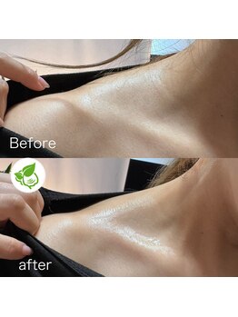 カイロプラクティック ネクサス/肩とデコルテライン撃退◇