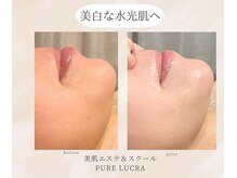 ピュアルクラ ＰＵＲＥ ＬＵＣＲＡの雰囲気（韓国肌管理とハーブピーリングでトーンアップ！韓国風水光肌へ）
