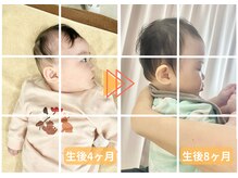 ラフィング(Laughing)/赤ちゃん整体