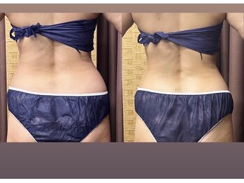 テラスアップ(Terrace UP)