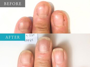 育爪 梅田店/育爪カルテ