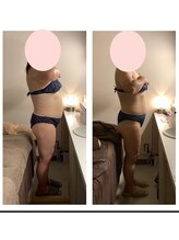 アクア エステティコ 亀有(ACQUA estetico)/痩身90分脂肪燃焼コース 4ヶ月後