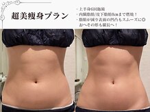 ラブミー 渋谷本店(LoveMe)/骨盤/上半身身痩せ/痩身/くびれ