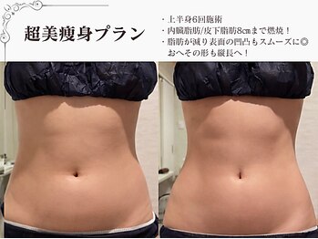 ラブミー 渋谷本店(LoveMe)/骨盤/上半身身痩せ/痩身/くびれ