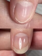 ミュウネイル 宜野湾(Myu nail)/