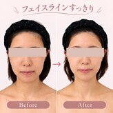 ナースリフェイス(Nurse Reface)