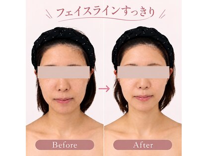 ナースリフェイス(Nurse Reface)の写真