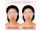 ナースリフェイス(Nurse Reface)の写真