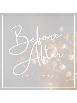 ミイン(美in)/ビフォーアフター