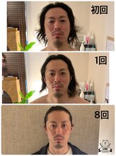 コガオテテ(Kogao tete)/ビフォーアフター　8回