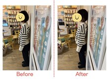 ハレノヒ(HARENOHI)/【猫背、巻き肩調整】