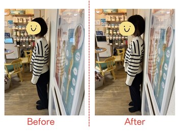 ハレノヒ(HARENOHI)/【猫背、巻き肩調整】