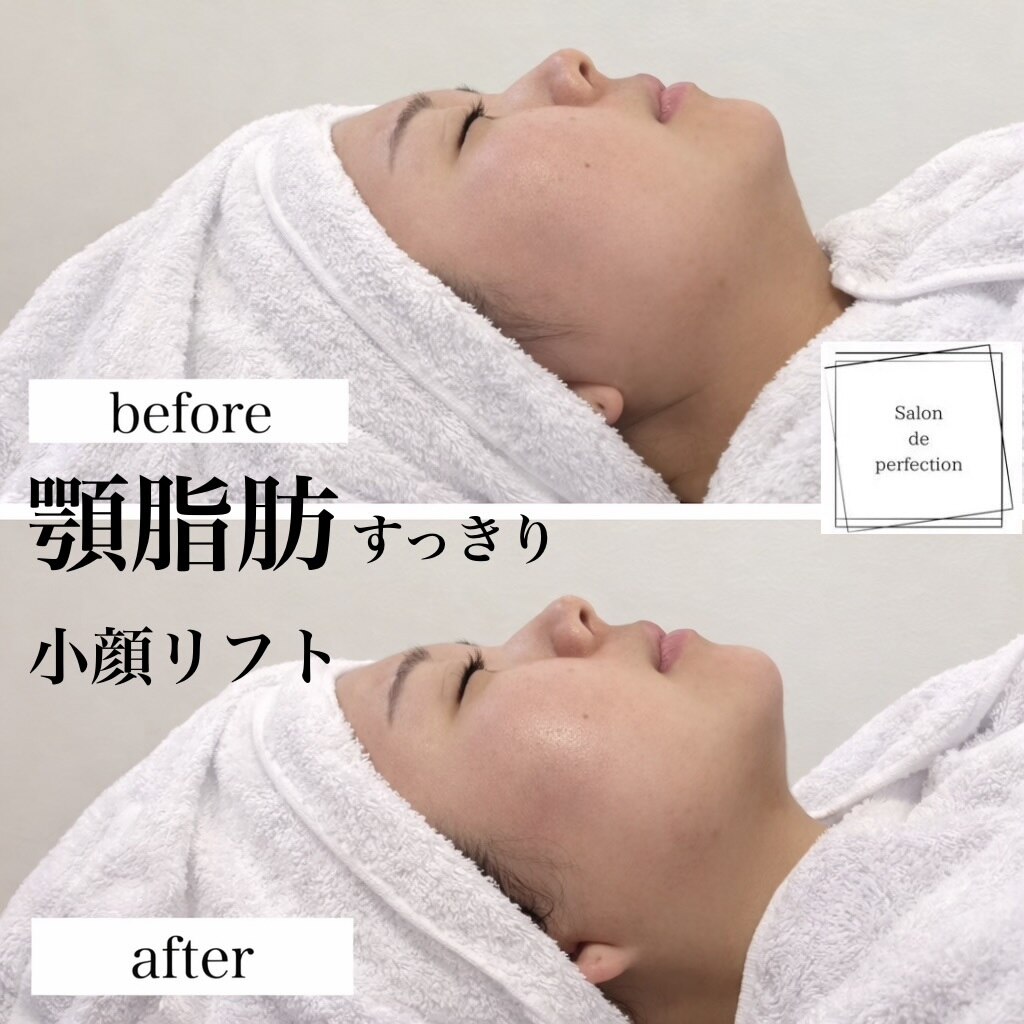 サロン ド パーフェクション(Salon de Perfection)｜ホットペッパー