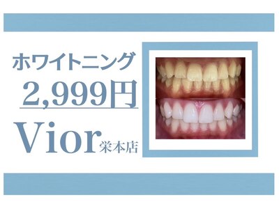 歯のセルフ ホワイトニング・通いやすい3回照射セット３９９９円