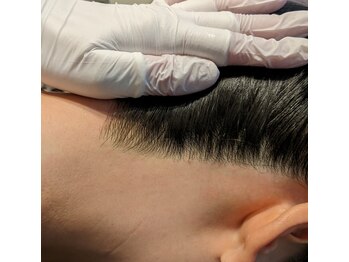 脱毛のお店 ニコ(NICO)/うなじMIX脱毛