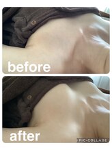 ギンザアール(GINZA R.)/バストアップ！