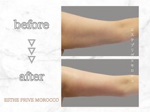 エステプリヴェモロッコ(ESTHE PRIVE MOROCCO)/オプションメニュー