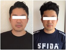 ウェリナ 一宮院/小顔矯正/骨盤矯正/痩身整体