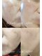 ラ ルーナ 本町(La Luna)の写真/【肌質改善専門】乾燥/毛穴/くすみ/ニキビ/赤みなど/肌トラブルの原因から改善!肌本来の美しさを♪
