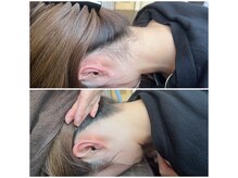 ミース 北九州店/『うなじビフォーアフター』