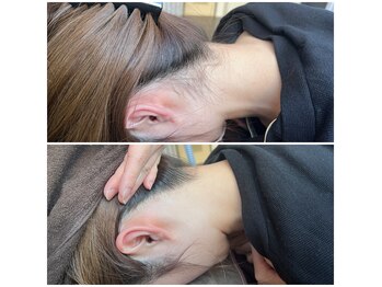 ミース 北九州店/『うなじビフォーアフター』