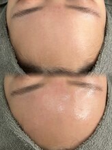 アエ メゾン(ae maison)/クリスタルスキンピーリング