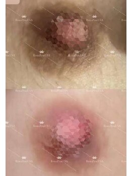 ツボミ(tubomi)/ローマピンク|バストトップ…4