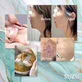 スズ(SUZU)
