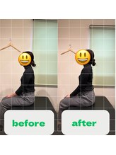 ナオル整体 長崎大村院(NAORU整体)/20代女性施術事例【猫背矯正】