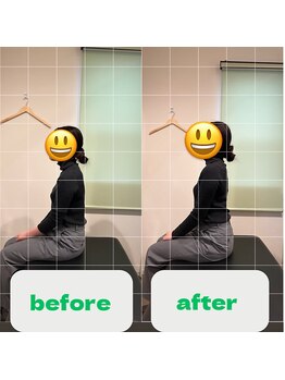 ナオル整体 長崎大村院(NAORU整体)/20代女性施術事例【猫背矯正】